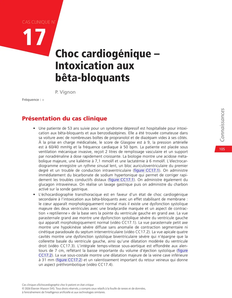 Cas cliniques d'échocardiographie chez le patient en état critique