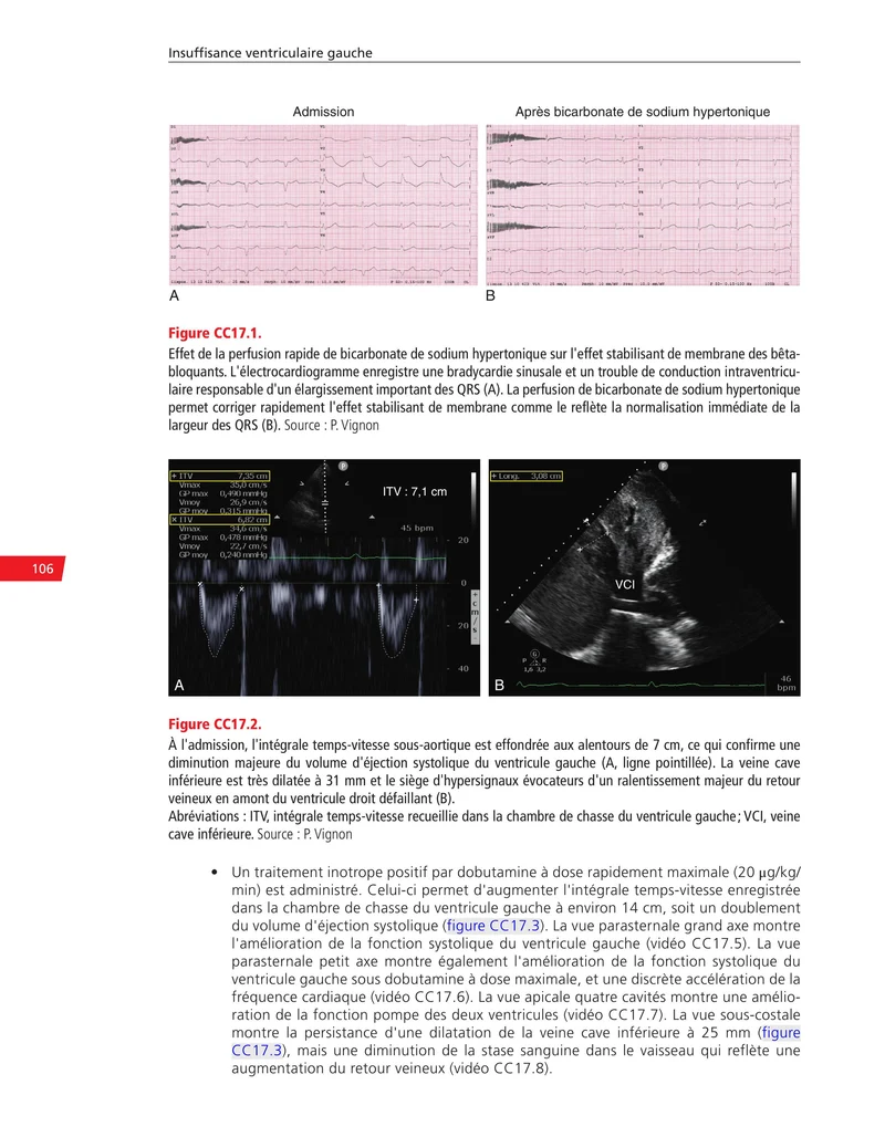 Cas cliniques d'échocardiographie chez le patient en état critique