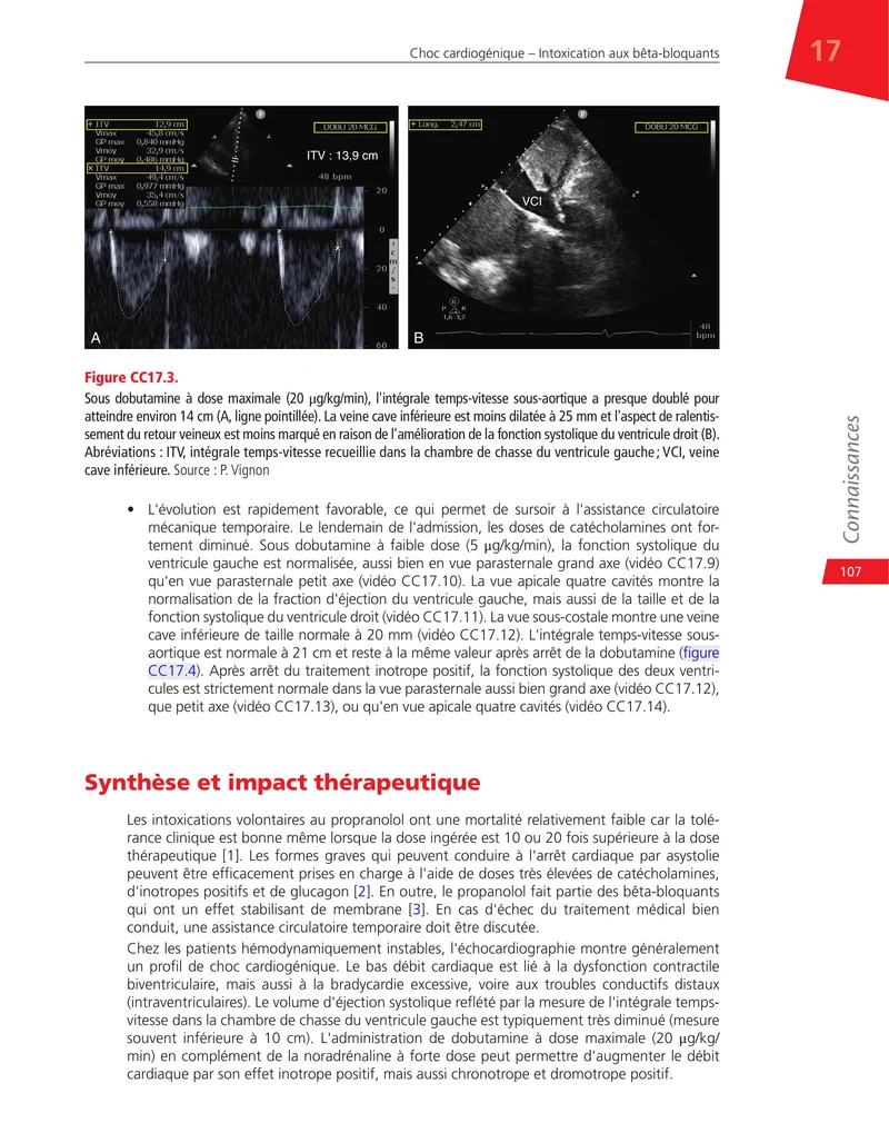 Cas cliniques d'échocardiographie chez le patient en état critique